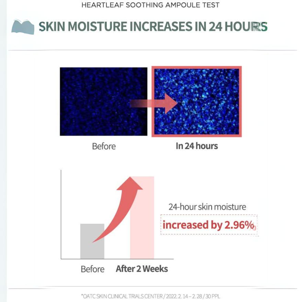 Anua Heartleaf 80% Soothing Ampoule for sensitive skin