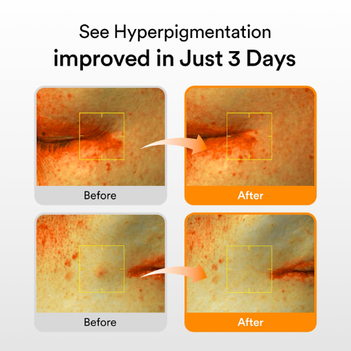 Abib Glutathiosome Dark Spot Serum with Vitamin C and Glutathione