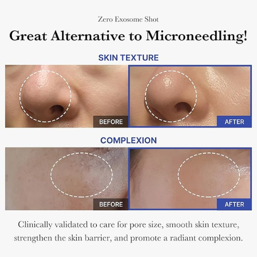 Medicube Exosome Shot Pore Ampoule for firm skin