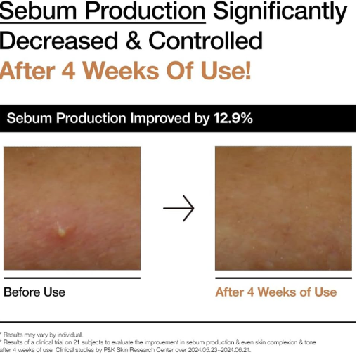 Anua Rice 70 Glow Milky Toner for Hydration and Brightening