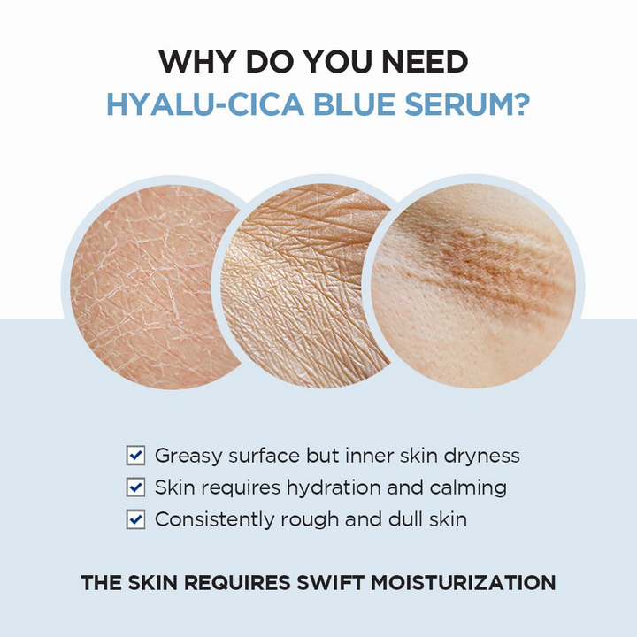SKIN 1004 Centella hydrating ceramide serum for sensitive skin